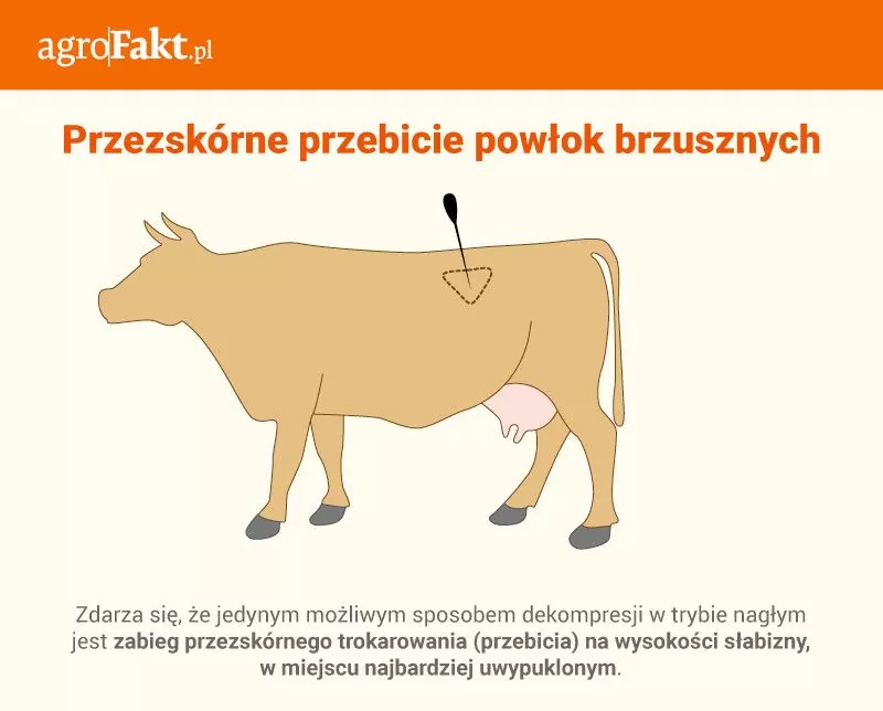 wzdęcie żwacza
